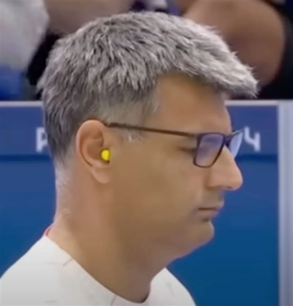 前世界冠軍告訴我們 土耳其殺手哥其實也沒那么神(圖19) 前世界冠軍告訴我們 土耳其殺手哥其實也沒那么神