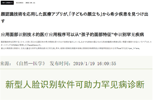 人臉識別又進(jìn)化：掃一下 我就知道你得了啥病
