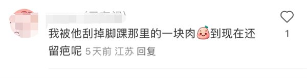 特斯拉Model Y座椅滑軌成車主噩夢 不少人被勾爛褲子、刮傷腿(圖8) 特斯拉Model Y座椅滑軌成車主噩夢 不少人被勾爛褲子、刮傷腿