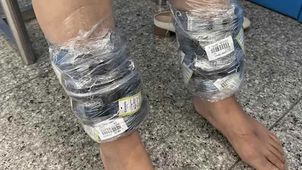 女子小腿綁40塊卡西歐手表進境 結果因步態僵硬被查獲(圖1) 女子小腿綁40塊卡西歐手表進境 結果因步態僵硬被查獲