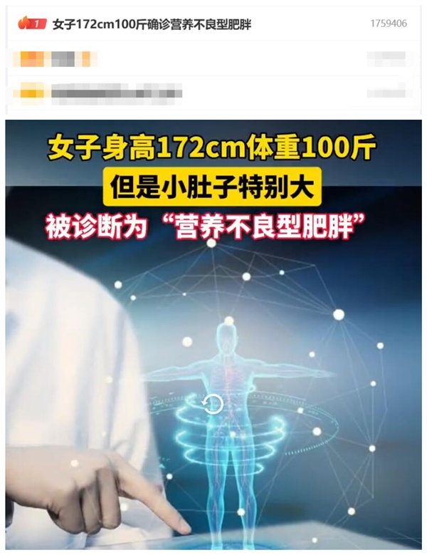 熱搜第一!女子172cm100斤確診營養(yǎng)不良型肥胖(圖2) 熱搜第一!女子172cm100斤確診營養(yǎng)不良型肥胖