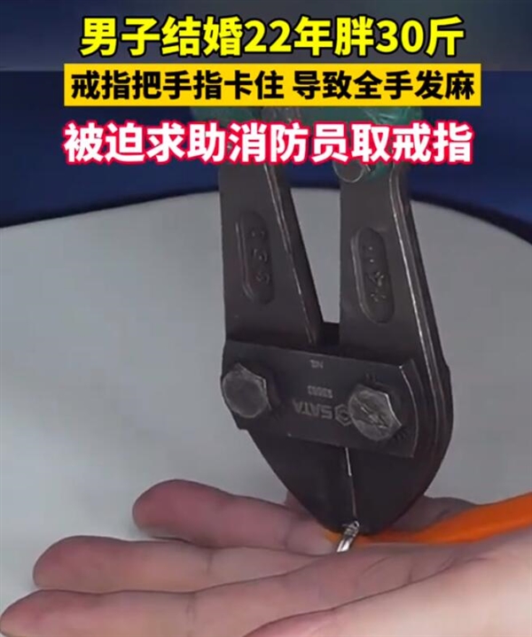 男子結婚22年胖30斤無奈夾斷婚戒：整個手都發麻了